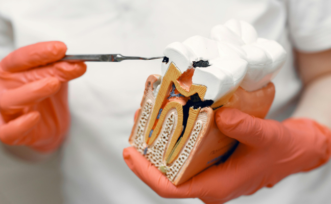 5 Key Benefits of Root Canal Treatment in Cary, NC