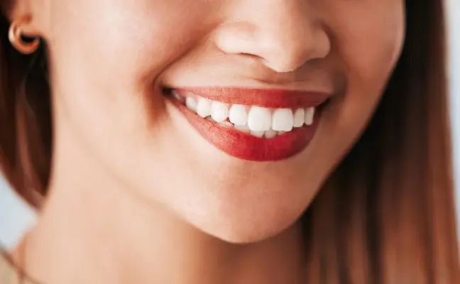 5 Major Advantages of Teeth Whitening in Cary, NC