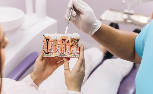 Root canal treatment in Cary NC explained with a dental tooth model