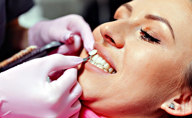 Dental Veneers in Apex and Cary NC